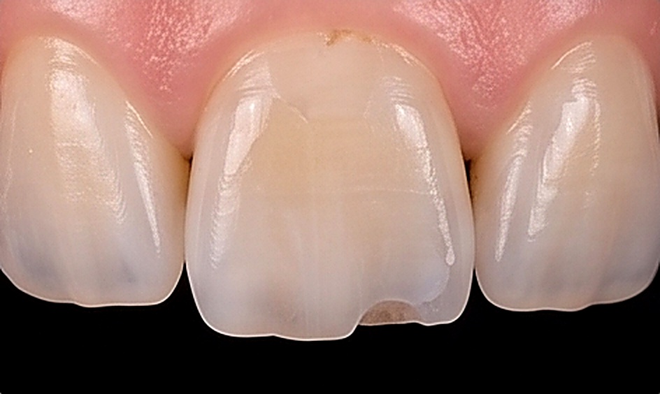 Cosmetic Corrections in Muscat