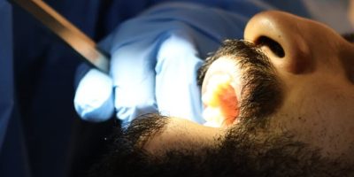 Affordable root canal treatment contact handsome dental clinic in Oman